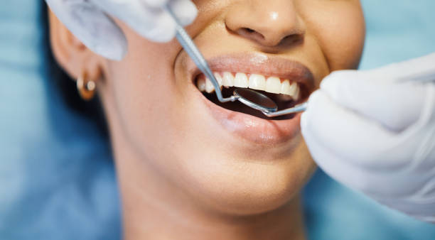 Best Lost Filling or Crown Replacement in Heathcote, NJ