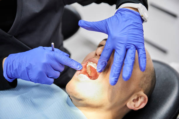 Best Emergency Wisdom Tooth Extraction in Heathcote, NJ